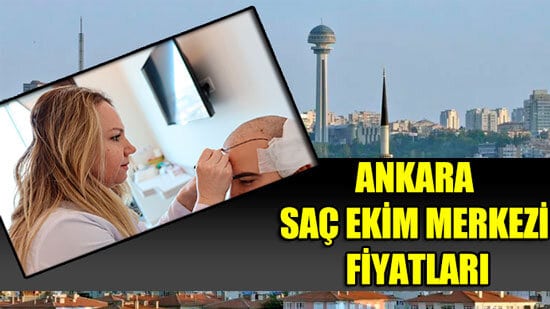 Ankara Saç Ekimi Fiyatları 2023 (En Çok Tercih Edilen Doktorlar)