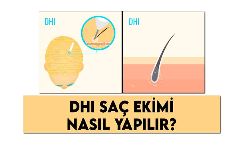 DHI Saç Ekimi Nasıl Yapılır? Yaptıranların Tavsiyeleri 2022
