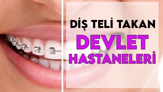 Diş Teli Takan Devlet Hastaneleri 2023 Fiyatları (GÜNCEL)