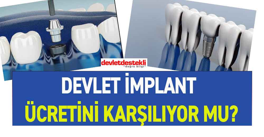 Devlet İmplantı Karşılıyor mu? SGK İmplant Fiyatları 2023