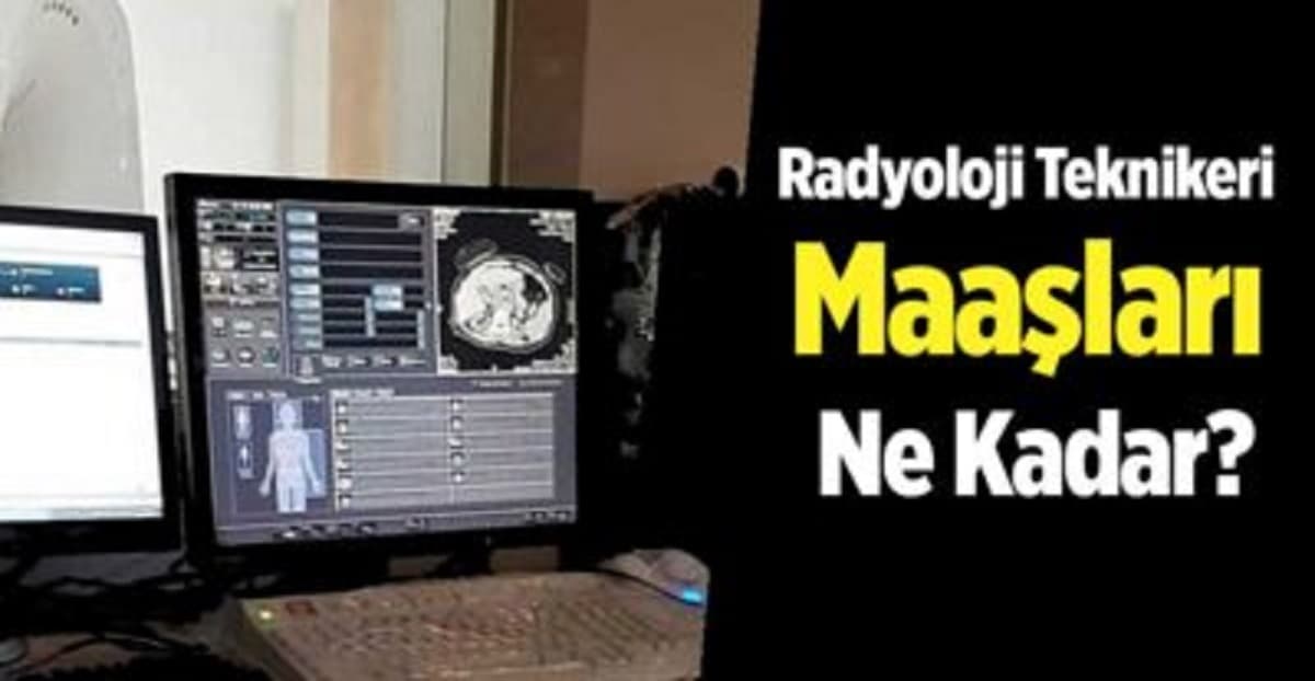 Radyoloji Teknikeri Maaşları Ne Kadar? 2023 Zamlı Net Maaş (ÖZEL-DEVLET)